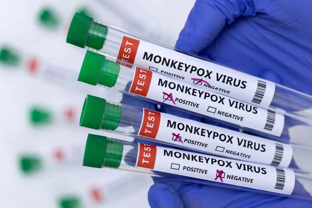 Is Their A Vaccine For Monkey Pox In Any Country?