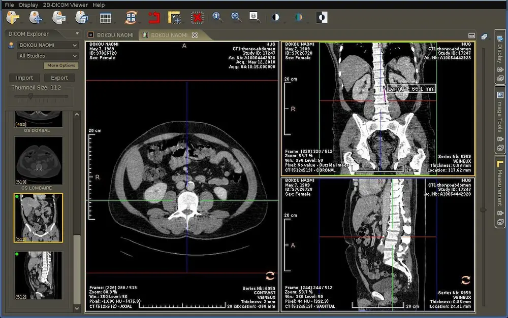 Best Pacs Radiology Software For Windows Pc 2022