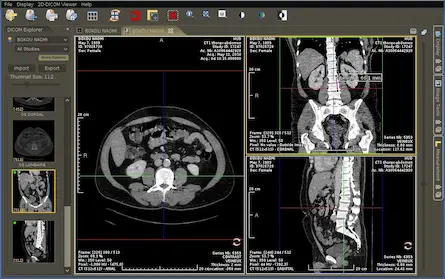 Best Pacs Radiology Software For Windows Pc 2022